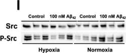 Invitrogen Donkey anti-Rabbit IgG (H+L) Highly Cross-Adsorbed Secondary