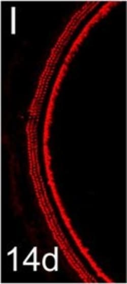 Invitrogen Donkey anti-Rabbit IgG (H+L) Highly Cross-Adsorbed Secondary
