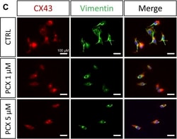 Invitrogen Goat anti-Mouse IgG (H+L) Cross-Adsorbed Secondary Antibody,