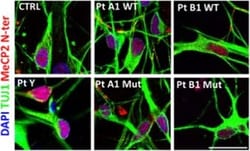 Invitrogen Goat anti-Mouse IgG (H+L) Cross-Adsorbed Secondary Antibody,