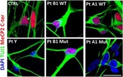 Invitrogen Goat anti-Mouse IgG (H+L) Cross-Adsorbed Secondary Antibody,