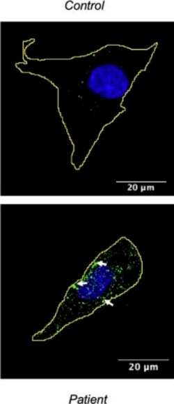 Invitrogen Goat anti-Rabbit IgG (H+L) Highly Cross-Adsorbed Secondary Antibody,