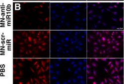 Invitrogen Goat anti-Mouse IgG1 Cross-Adsorbed Secondary Antibody, Alexa Fluor 594 500 &mu;g | Buy Online | Invitrogen&trade; | Fisher Scientific