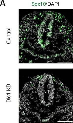 Invitrogen Goat anti-Rabbit IgG (H+L) Cross-Adsorbed Secondary Antibody,