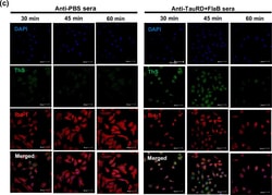 Invitrogen Donkey anti-Rabbit IgG (H+L) Highly Cross-Adsorbed Secondary