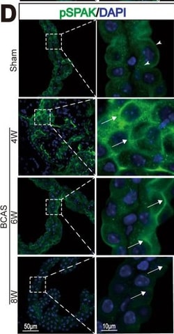 Invitrogen Goat anti-Rabbit IgG (H+L) Cross-Adsorbed Secondary Antibody,