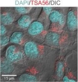 Invitrogen Goat anti-Rabbit IgG (H+L) Cross-Adsorbed Secondary Antibody,