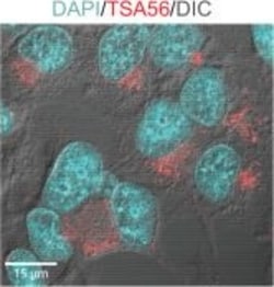 Invitrogen Goat anti-Rabbit IgG (H+L) Cross-Adsorbed Secondary Antibody,