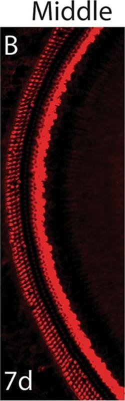 Invitrogen Donkey anti-Rabbit IgG (H+L) Highly Cross-Adsorbed Secondary