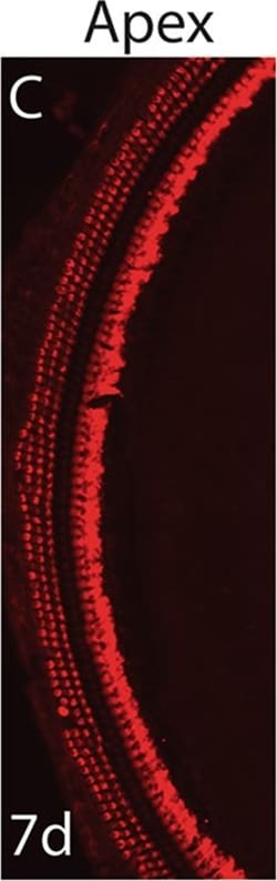 Invitrogen Donkey anti-Rabbit IgG (H+L) Highly Cross-Adsorbed Secondary