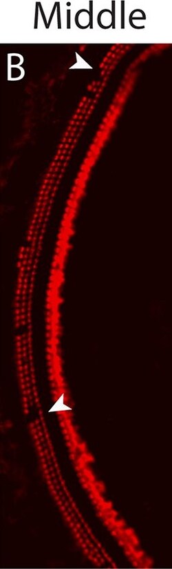 Invitrogen Donkey anti-Rabbit IgG (H+L) Highly Cross-Adsorbed Secondary