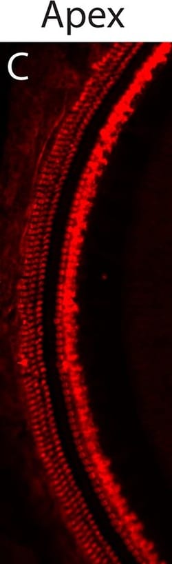 Invitrogen Donkey anti-Rabbit IgG (H+L) Highly Cross-Adsorbed Secondary