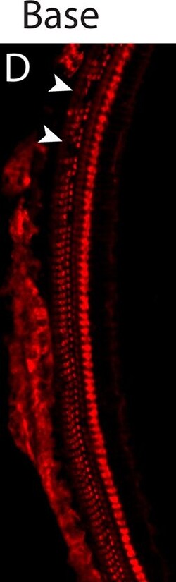 Invitrogen Donkey anti-Rabbit IgG (H+L) Highly Cross-Adsorbed Secondary