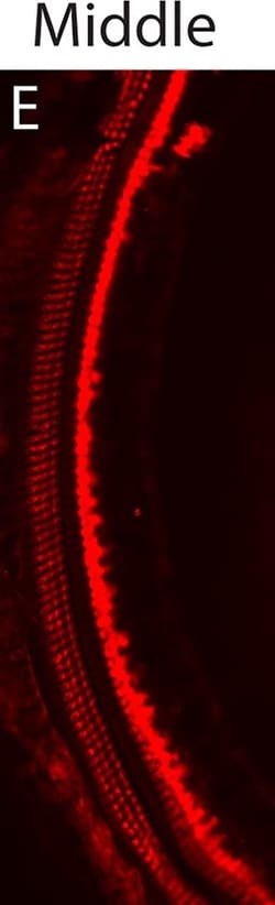 Invitrogen Donkey anti-Rabbit IgG (H+L) Highly Cross-Adsorbed Secondary
