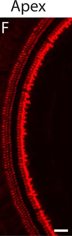 Invitrogen Donkey anti-Rabbit IgG (H+L) Highly Cross-Adsorbed Secondary
