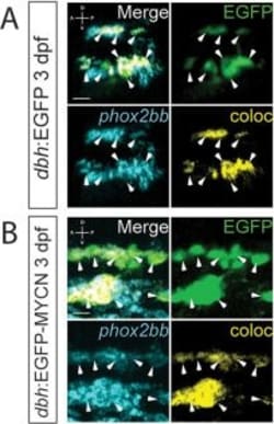 Invitrogen Goat anti-Rabbit IgG (H+L) Cross-Adsorbed Secondary Antibody,