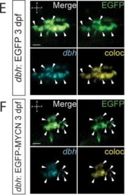 Invitrogen Goat anti-Rabbit IgG (H+L) Cross-Adsorbed Secondary Antibody,