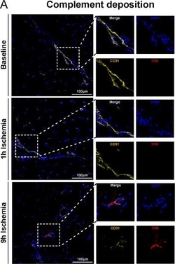 Invitrogen Donkey anti-Mouse IgG (H+L) Highly Cross-Adsorbed Secondary