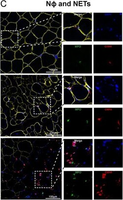 Invitrogen Donkey anti-Mouse IgG (H+L) Highly Cross-Adsorbed Secondary