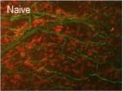 Invitrogen Goat anti-Rabbit IgG (H+L) Cross-Adsorbed Secondary Antibody,