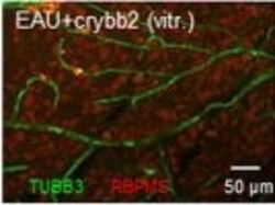 Invitrogen Goat anti-Rabbit IgG (H+L) Cross-Adsorbed Secondary Antibody,