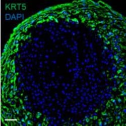 Invitrogen Goat anti-Rabbit IgG (H+L) Cross-Adsorbed Secondary Antibody, DyLight 488 500 &mu;L | Buy Online | Invitrogen&trade; | Fisher Scientific