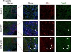 Invitrogen Goat anti-Rabbit IgG (H+L) Cross-Adsorbed Secondary Antibody,