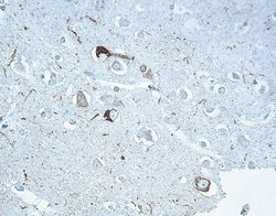 Tau Monoclonal Antibody (T14), Invitrogen 100 &mu;g; Unconjugated:Antibodies,