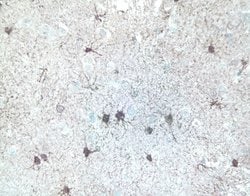 Invitrogen ERK1/ERK2 Monoclonal Antibody (ERK-7D8) 200 &mu;g; Unconjugated:Antibodies,