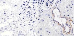 FGFR1 Monoclonal Antibody (VBS-7), Invitrogen™