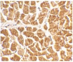 Invitrogen CX3CR1 Polyclonal Antibody, eBioscience 50 &mu;g; Unconjugated:Antibodies,