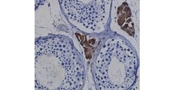 Invitrogen MERTK Monoclonal Antibody (A3KCAT), eBioscience 100 &mu;g; Unconjugated:Antibodies,