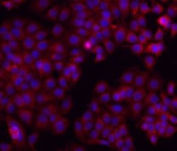 Osteopontin Monoclonal Antibody (2F10), eBioscience , Invitrogen 100 &mu;g;
