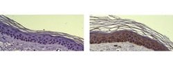 Invitrogen Cytokeratin 6 Monoclonal Antibody (LL020), eBioscience 100 &mu;g;
