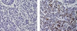 Cutaneous Lymphocyte Antigen (CLA) Monoclonal Antibody (HECA-452), eBioscience:Antibodies,