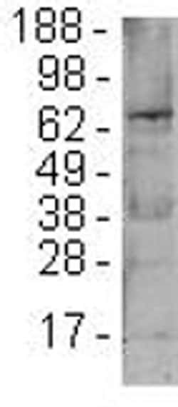 Invitrogen FOXP1 Monoclonal Antibody (JC12 (JC-12)), eBioscience:Antibodies:Primary