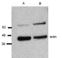 Invitrogen Perforin Monoclonal Antibody (eBioBOR21), eBioscience 100 &mu;g;