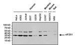 Thumbnail_Goat anti-Mouse IgG (H+L) Secondary Antibody, HRP, Invitrogen 2 mL; HRP:Antibodies,