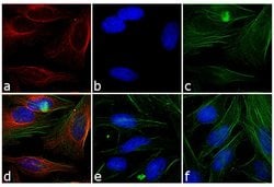 Invitrogen Goat anti-Mouse IgG Fc Secondary Antibody, Rhodamine 2 mg; Rhodamine:Antikörper