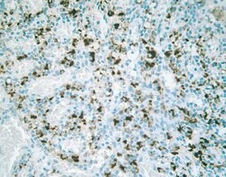 Claudin 2 Monoclonal Antibody (12H12):Antibodies, Monoclonal