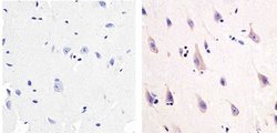 Invitrogen NMDAR1 Monoclonal Antibody (54.1) 100 &mu;g; Unconjugated:Antibodies,