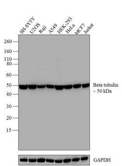 Invitrogen beta Tubulin Monoclonal Antibody (2 28 33) 100 &mu;g; Unconjugated:Antibodies,