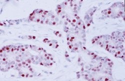Invitrogen Cyclin D1 Monoclonal Antibody (AM29) 100 &mu;g; Unconjugated:Antibodies,