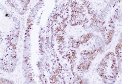 Invitrogen MSH2 Monoclonal Antibody (FE11) 50 &mu;g | Buy Online | Invitrogen&trade; | Fisher Scientific