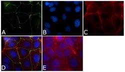 Invitrogen ZO-1 Monoclonal Antibody (ZO1-1A12), FITC 100 &mu;g; FITC:Antibodies,