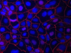 Invitrogen ZO-1 Monoclonal Antibody (ZO1-1A12), Alexa Fluor 594 100 &mu;g;