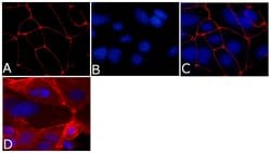 Invitrogen ZO-1 Monoclonal Antibody (ZO1-1A12), Alexa Fluor 594 100 &mu;g;