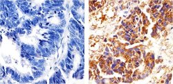Invitrogen delta Catenin Monoclonal Antibody (6H11) 100 &mu;L; Unconjugated:Antibodies,