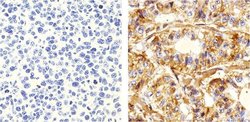 Invitrogen delta Catenin Monoclonal Antibody (6H11) 100 &mu;L; Unconjugated:Antibodies,