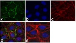 Invitrogen delta Catenin Monoclonal Antibody (6H11) 100 &mu;L; Unconjugated:Antibodies,